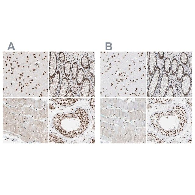 Anti-FAM98B antibody produced in rabbit