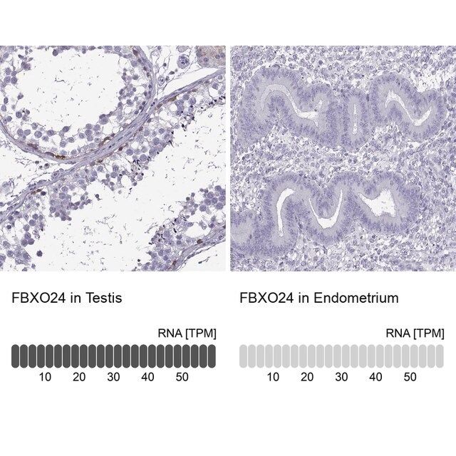 Anti-FBXO24 antibody produced in rabbit