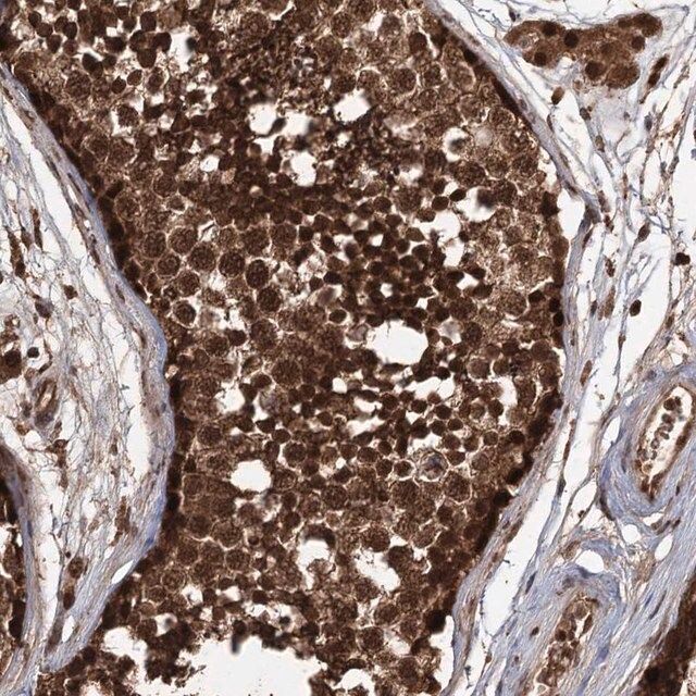 Anti-FBXO7 antibody produced in rabbit