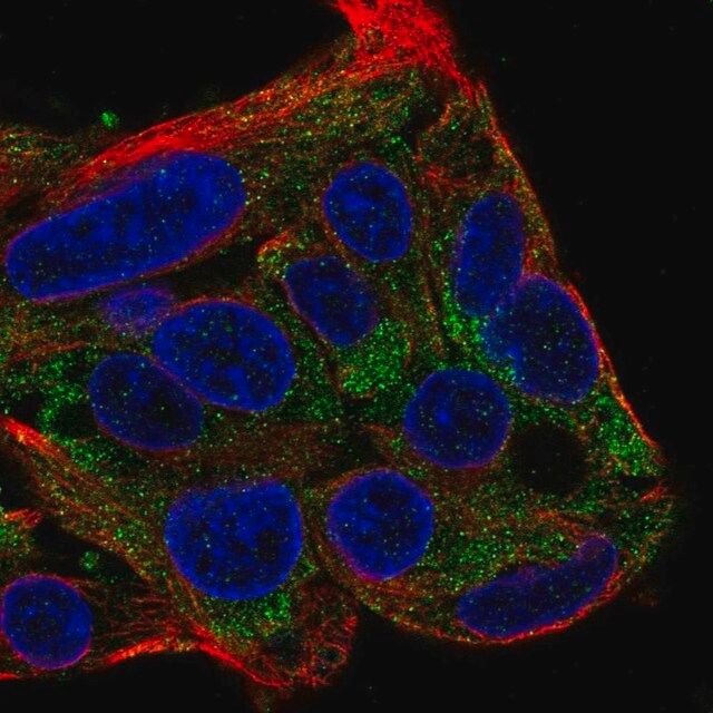 Anti-FBXL22 antibody produced in rabbit