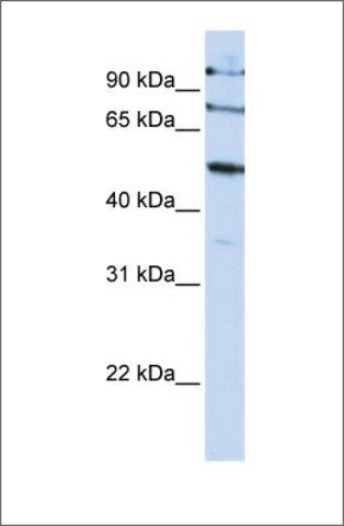 Anti-FBXO5 antibody produced in rabbit