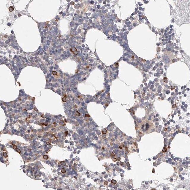 Anti-FBXO43 antibody produced in rabbit