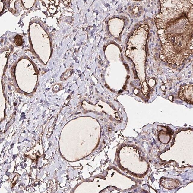 Anti-FBXO34 antibody produced in rabbit