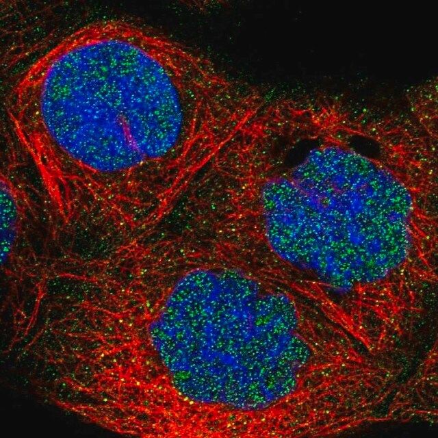 Anti-FBXO11 antibody produced in rabbit