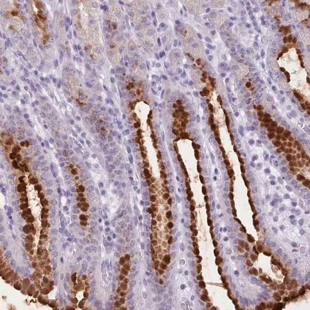 Anti-FBXO48 antibody produced in rabbit