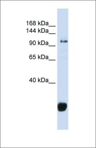 Anti-FBXO10 antibody produced in rabbit