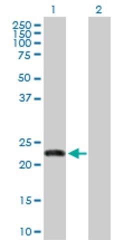 Anti-FBXO36 antibody produced in rabbit