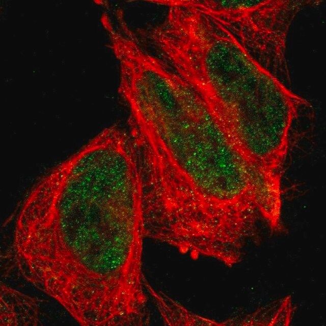 Anti-FBXO4 antibody produced in rabbit