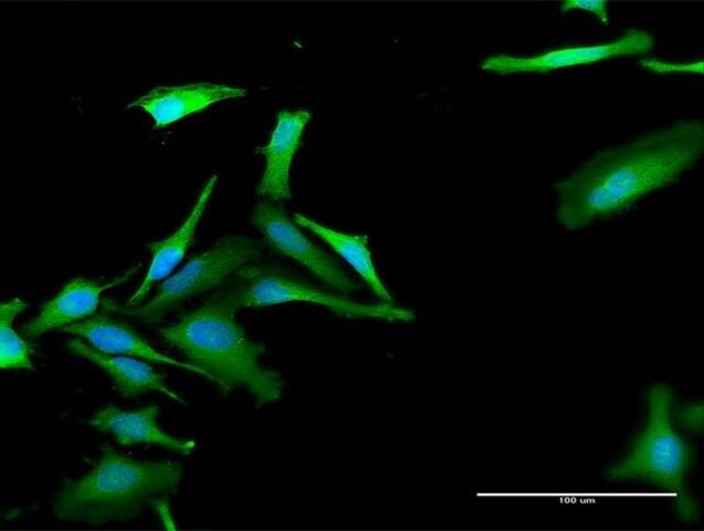 Anti-FBXO42 antibody produced in rabbit