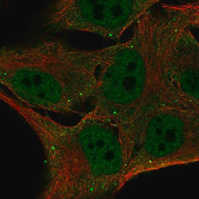 Anti-FBXO16 antibody produced in rabbit