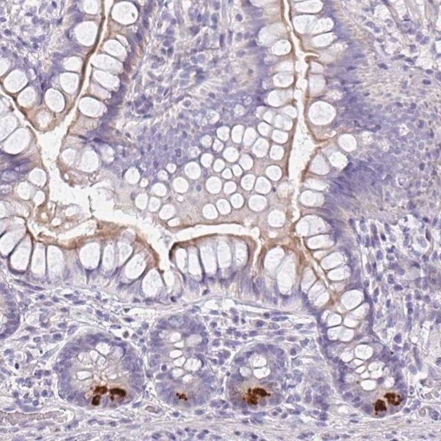 Anti-FBXO47 antibody produced in rabbit