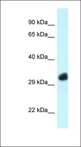 Anti-FBXO22 antibody produced in rabbit