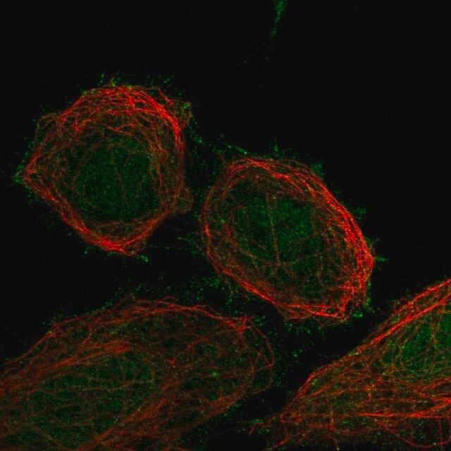 Anti-FBXO41 antibody produced in rabbit