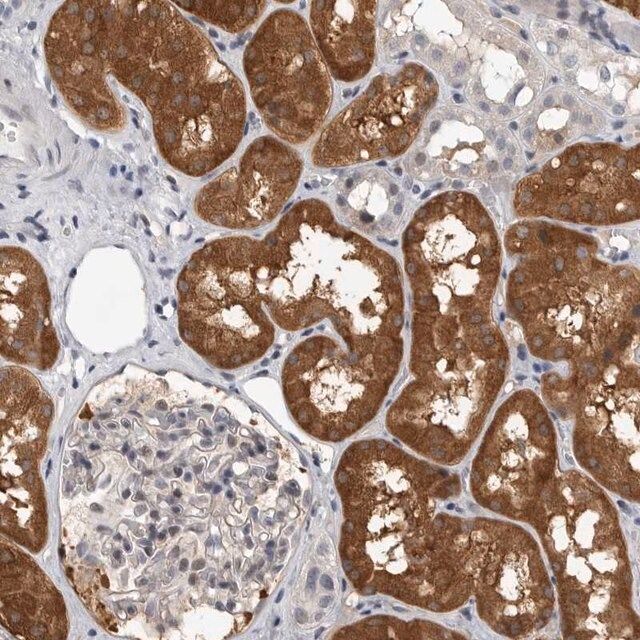 Anti-FBXO43 antibody produced in rabbit