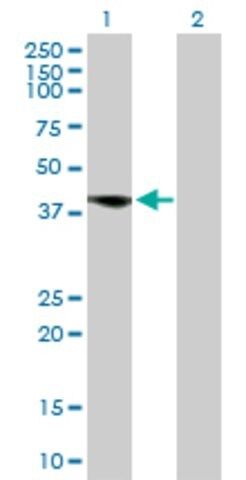 Anti-FCER2 antibody produced in rabbit