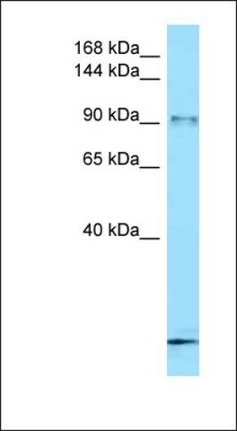 Anti-FBXO11 antibody produced in rabbit