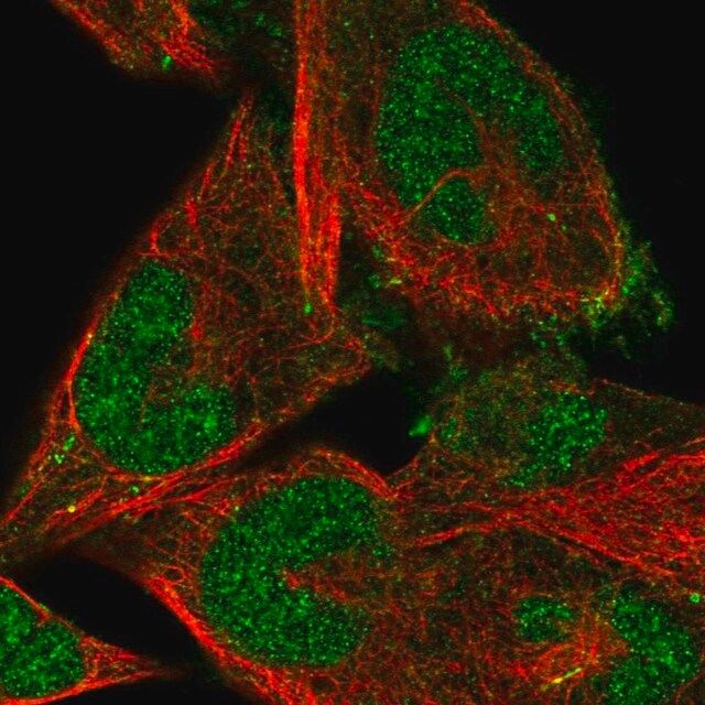 Anti-FBXO41 antibody produced in rabbit