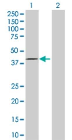 Anti-FBXO28 antibody produced in rabbit