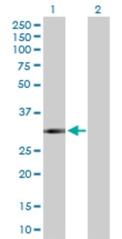 Anti-FCN3 antibody produced in rabbit