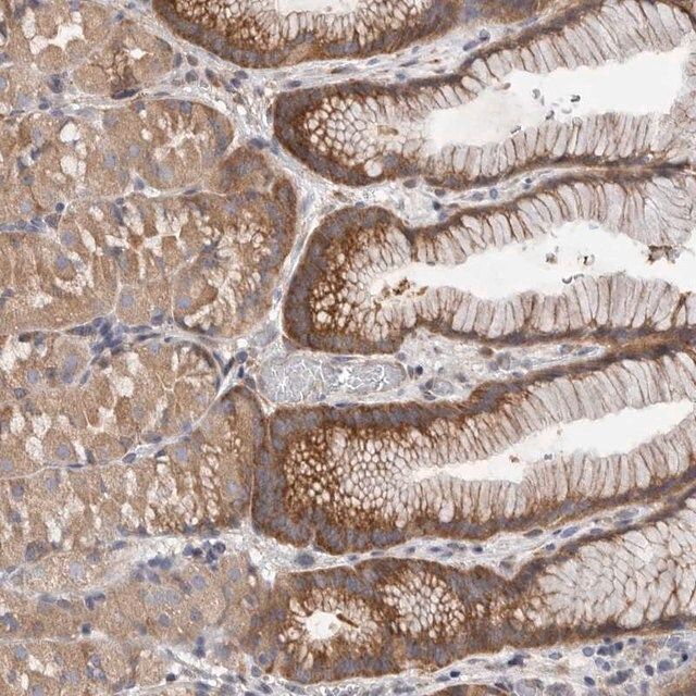 Anti-FBXO43 antibody produced in rabbit