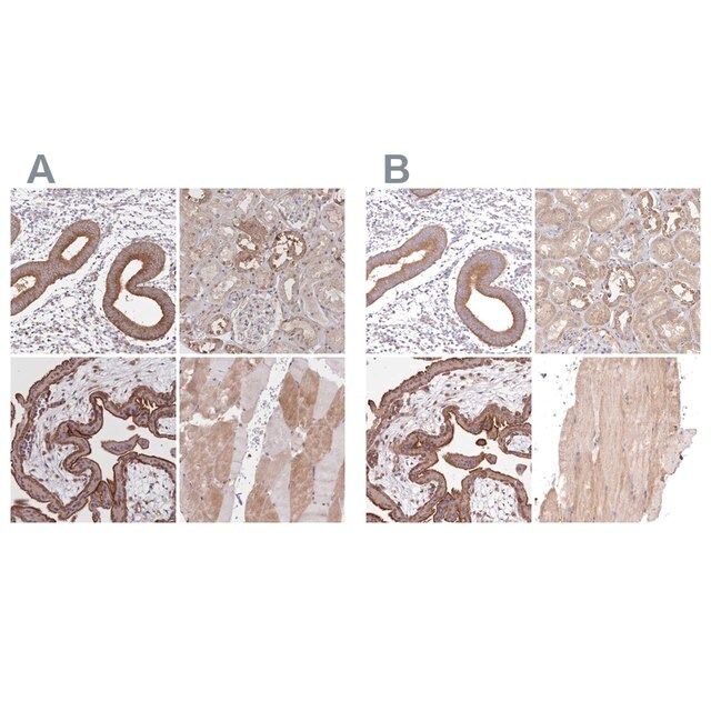 Anti-FCHO2 antibody produced in rabbit