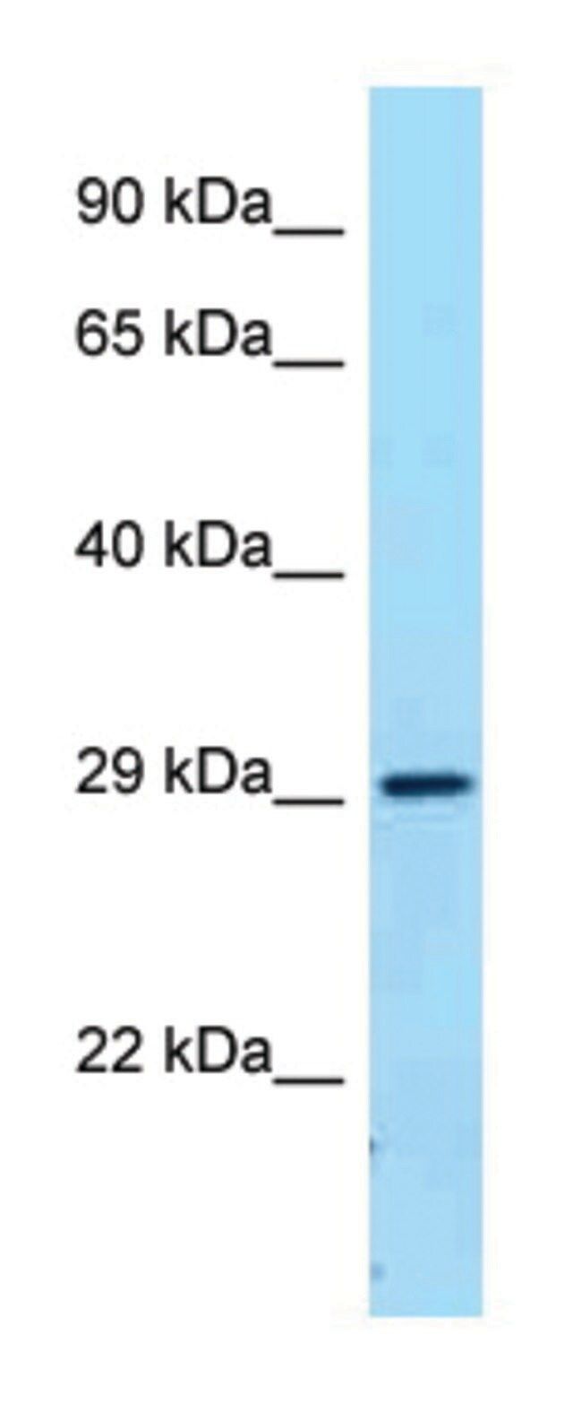 Anti-FCGR2B (C-terminal) antibody produced in rabbit