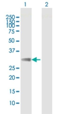 Anti-FCAR antibody produced in mouse