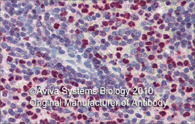 Anti-FCHO1 antibody produced in rabbit