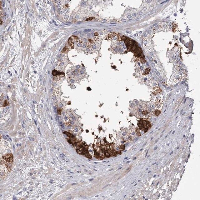 Anti-FDXACB1 antibody produced in rabbit