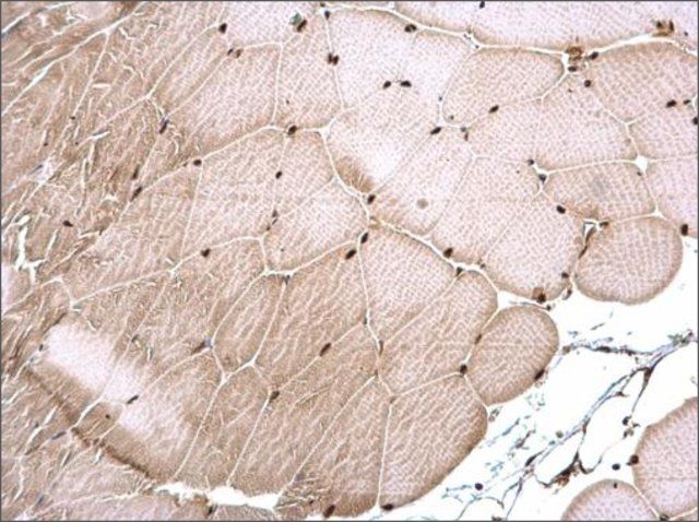 Anti-ERCC6 antibody produced in rabbit