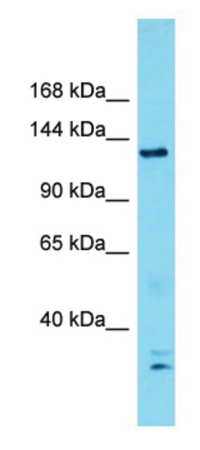 Anti-ERCC5 (N-terminal) antibody produced in rabbit