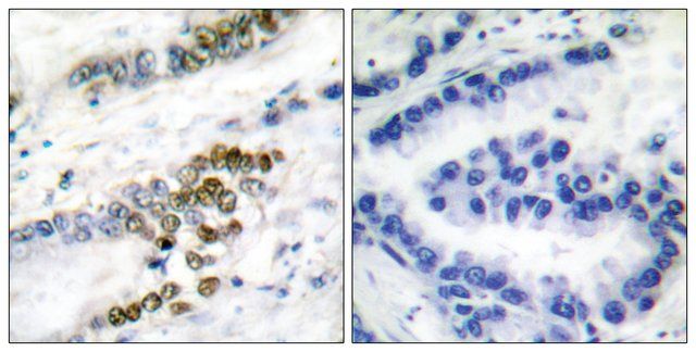 Anti-ERCC1 antibody produced in rabbit