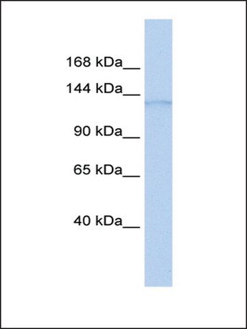 Anti-ERCC5 antibody produced in rabbit