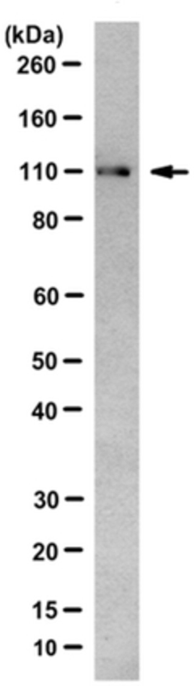 Anti-ERAP1 Antibody, clone 16A7.1