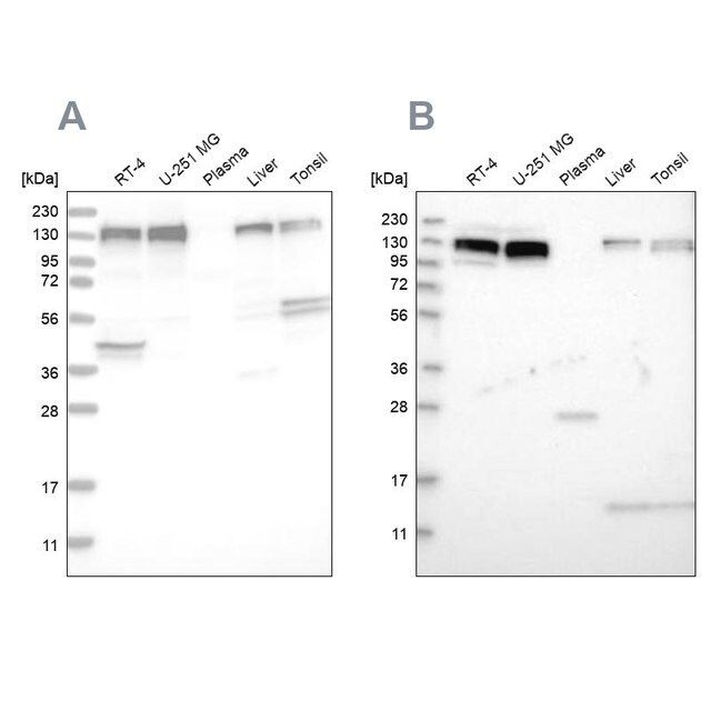 Anti-ERC1 antibody produced in rabbit