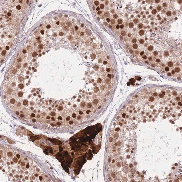 Anti-ERCC2 antibody produced in rabbit