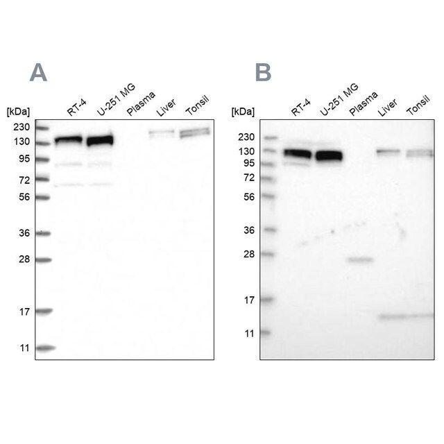 Anti-ERC1 antibody produced in rabbit