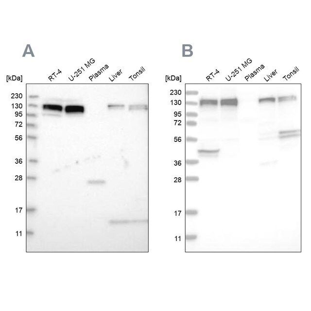 Anti-ERC1 antibody produced in rabbit