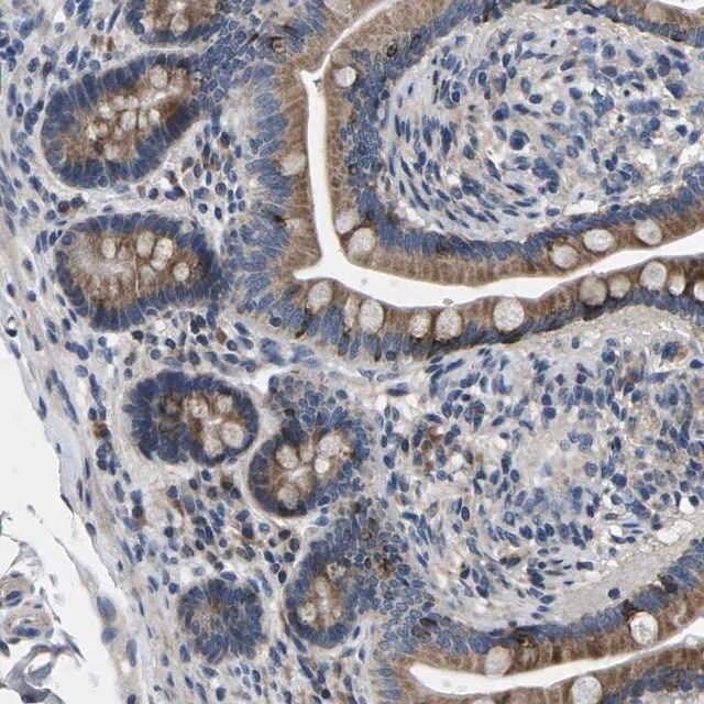 Anti-ERGIC3 antibody produced in rabbit