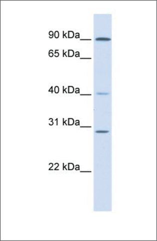 Anti-ERCC2 antibody produced in rabbit