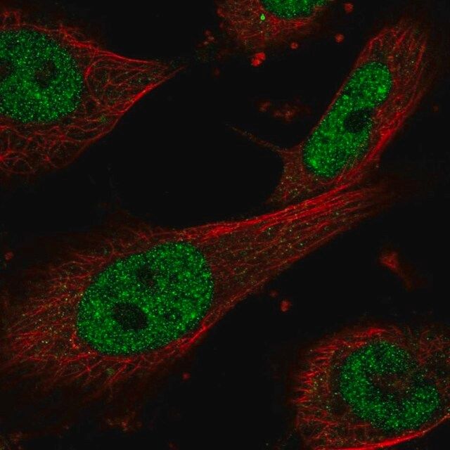 Anti-ERCC1 antibody produced in rabbit