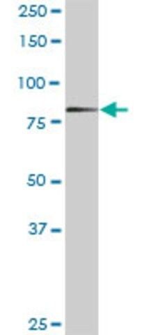 Anti-ERCC2 antibody produced in rabbit