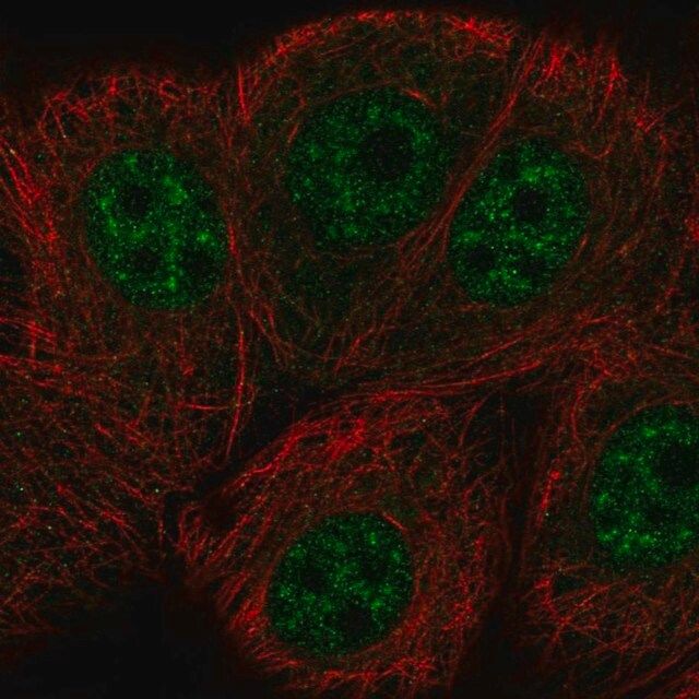 Anti-ERCC8 antibody produced in rabbit