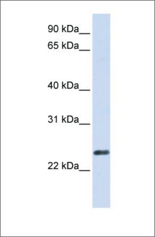 Anti-ERVWE1 antibody produced in rabbit