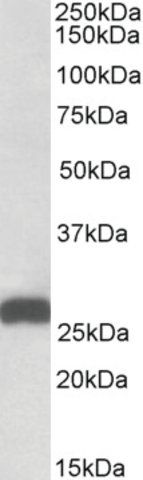 Anti-ETFB (C-terminal) antibody produced in goat