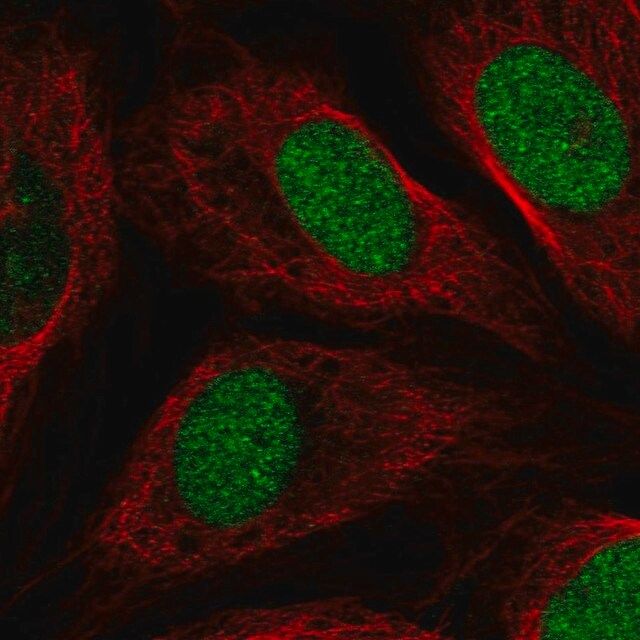 Anti-ETNPPL antibody produced in rabbit