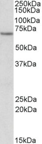 Anti-ETFDH antibody produced in goat