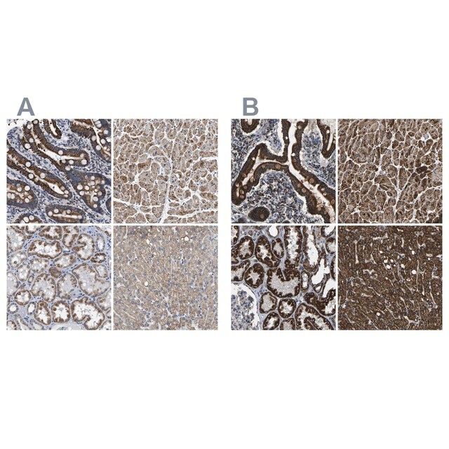 Anti-ETFA antibody produced in rabbit