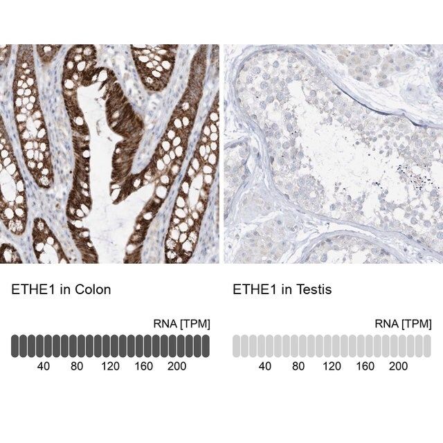 Anti-ETHE1 antibody produced in rabbit