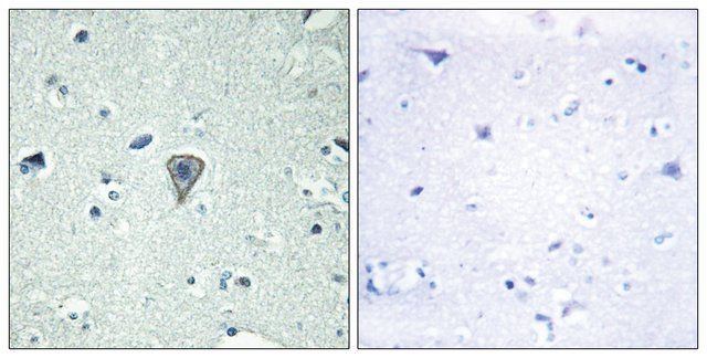 Anti-ETBR2 antibody produced in rabbit